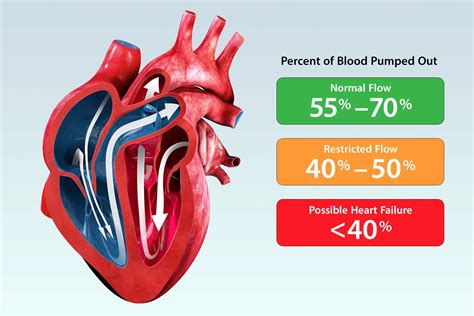 Ejection Fraction: Definition, Measurement, Causes, and Treatment